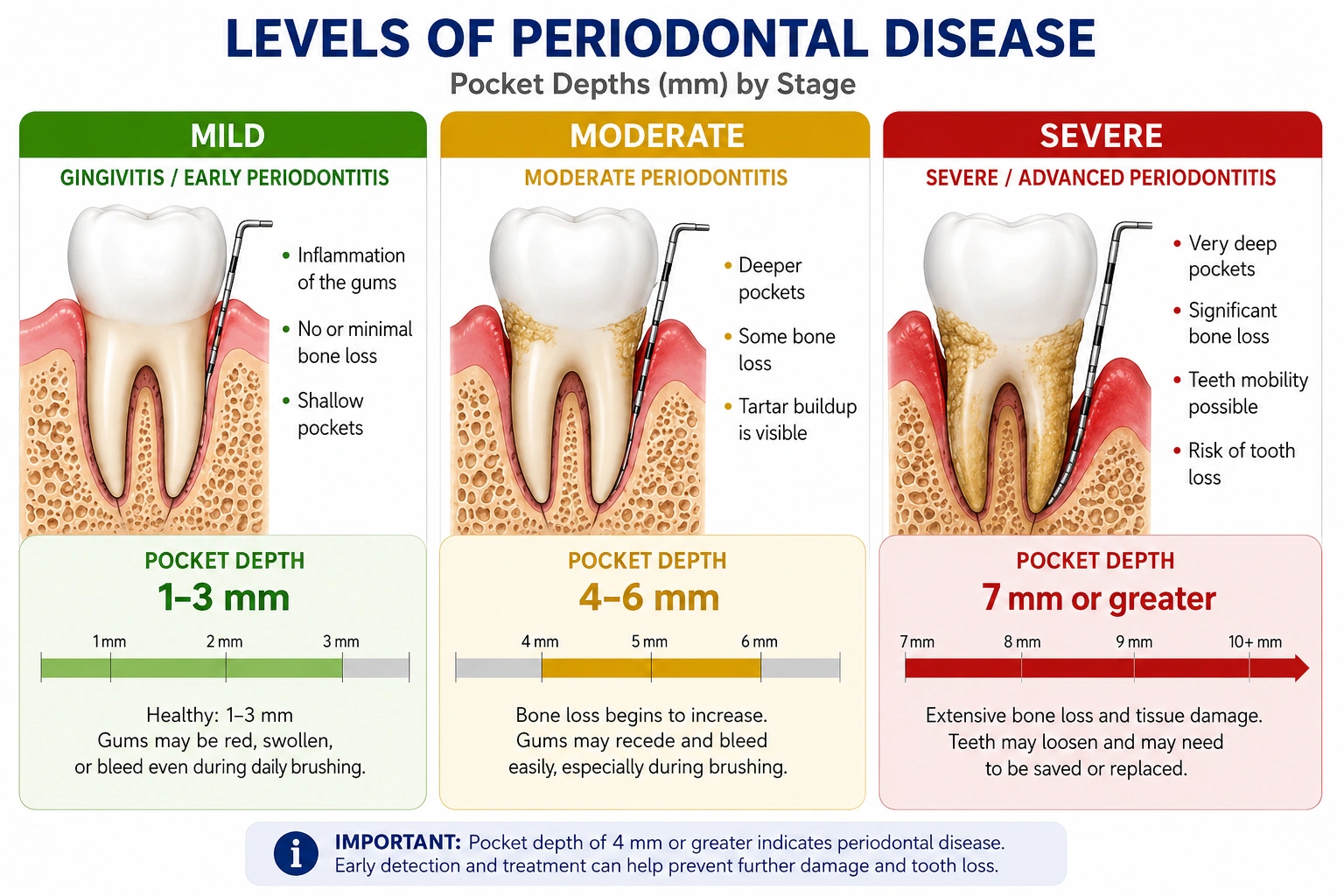 Gum Disease Stage