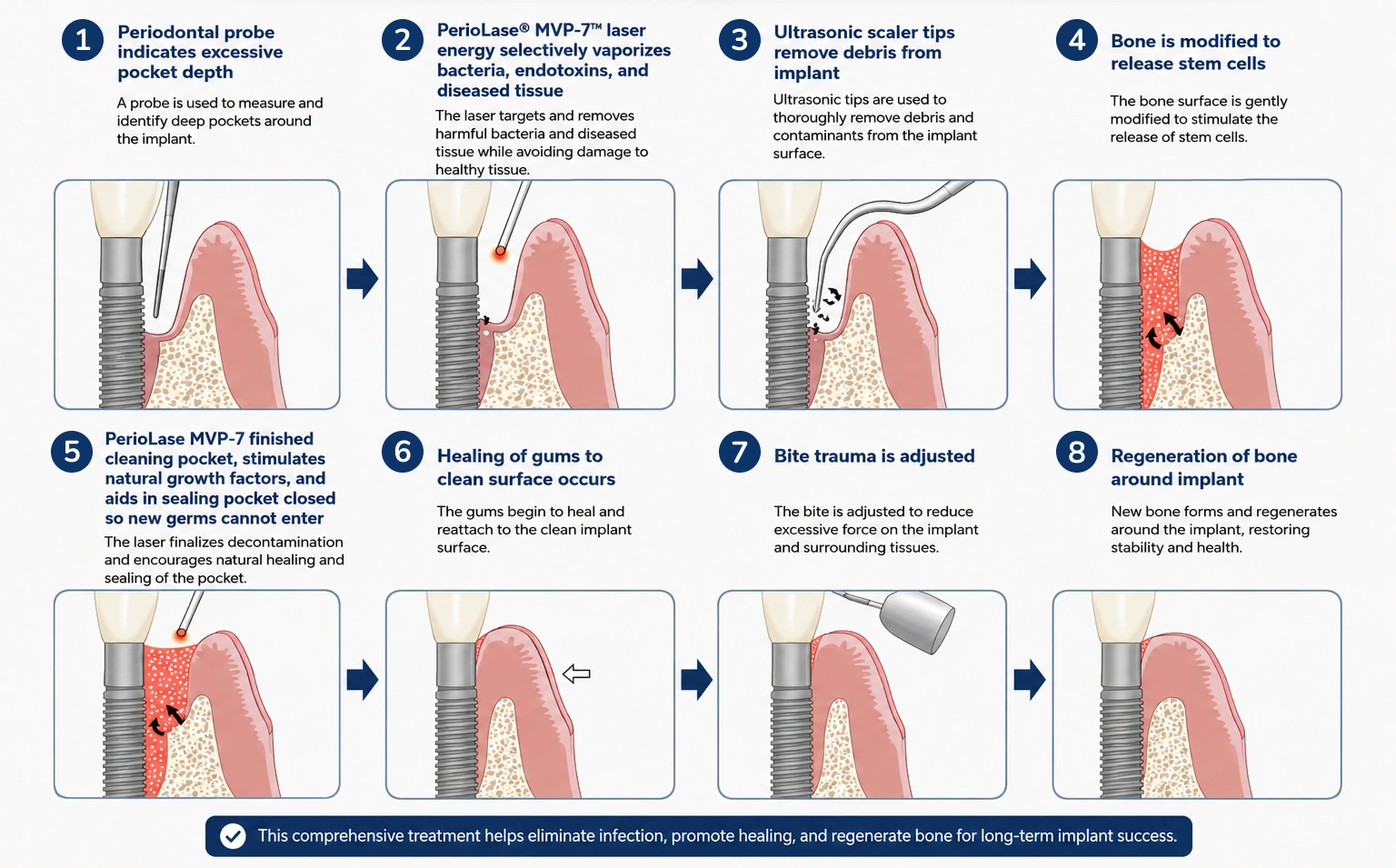How the LAPIP Treatment Procedure Works