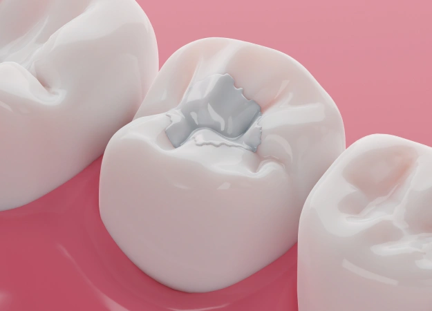 A Cavity Isn’t the End of the World We Promise