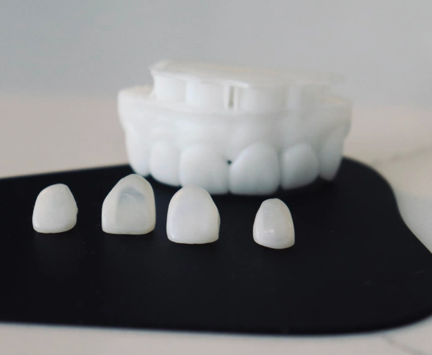 Custom porcelain veneers designed to enhance the appearance of stained, chipped, and uneven front teeth.